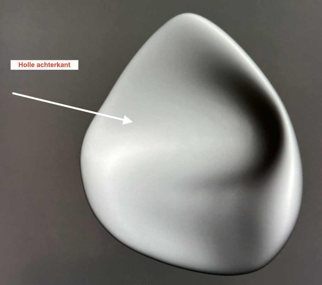 AFT-traject: prothese